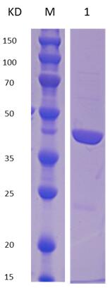12% SDS-PAGE analysis profiles of purified MCR_RS07795-20-368 (CBB stained).